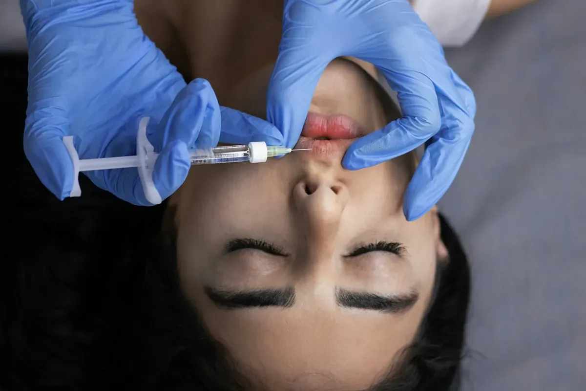 Aplicación de toxina botulínica en el rostro