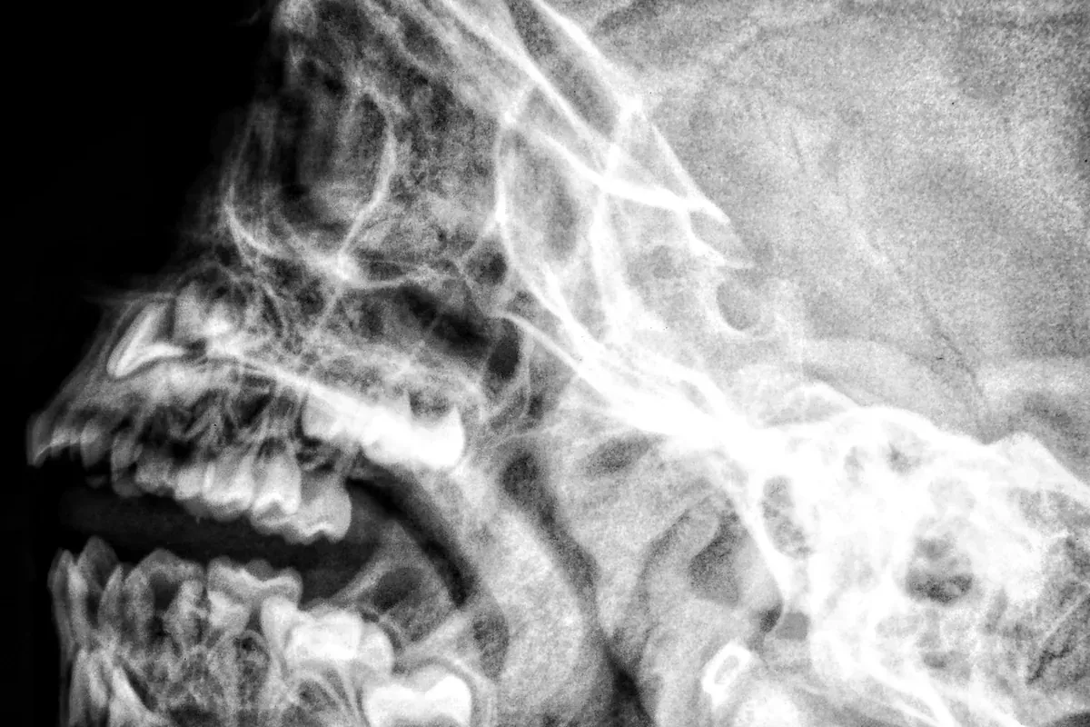 Radiografía del cráneo y la articulación temporomandibular