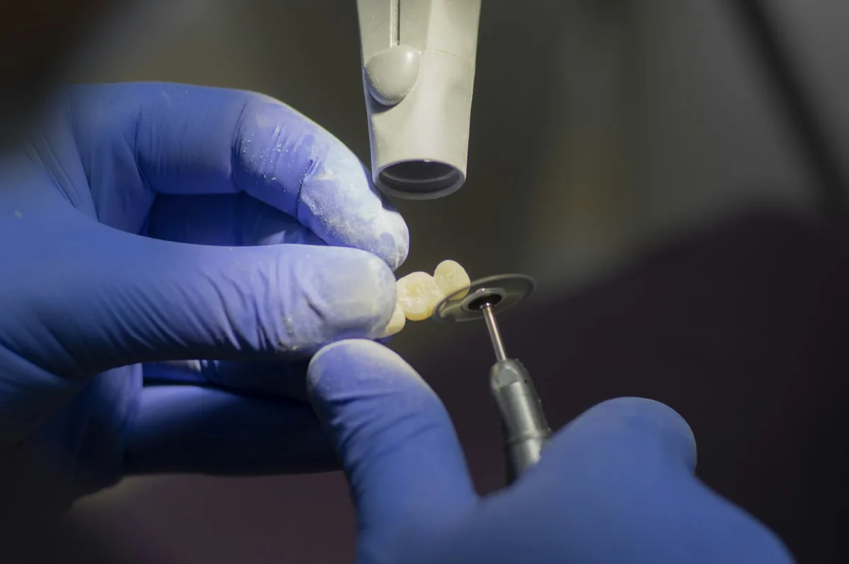 Colocación de un implante dental