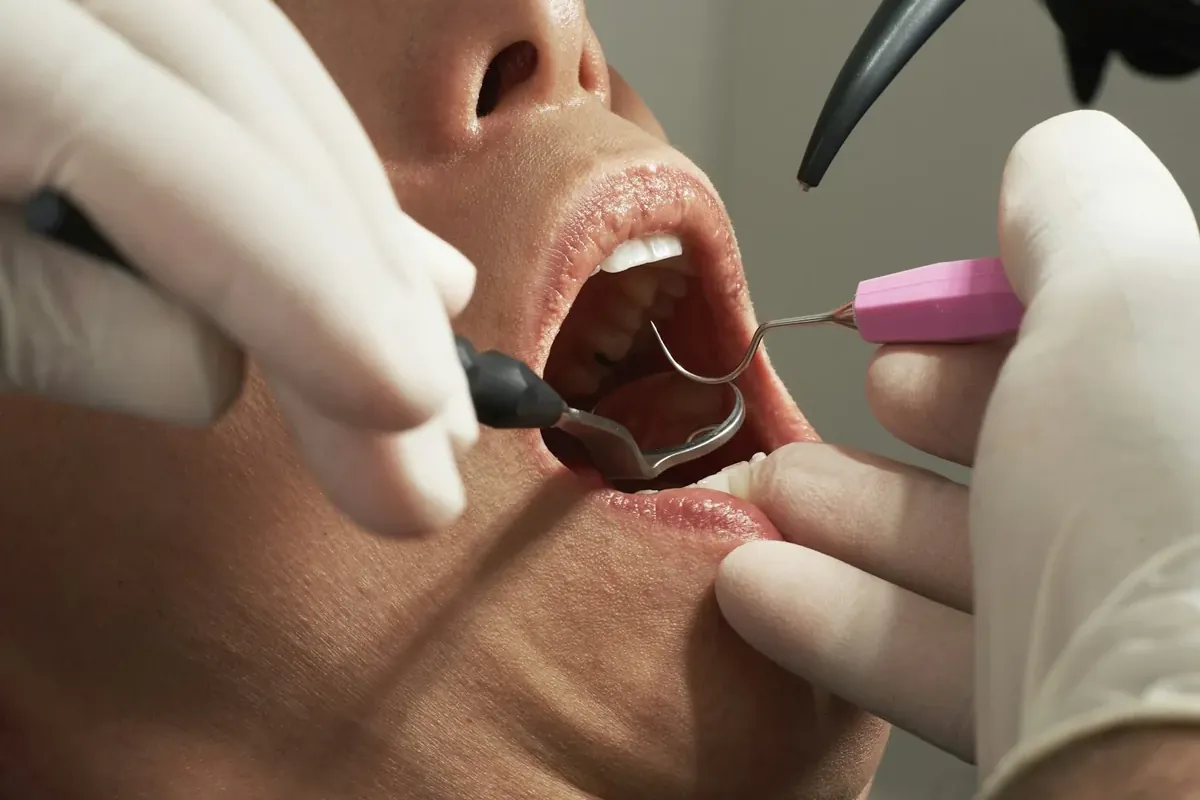 Odontóloga realizando una limpieza dental